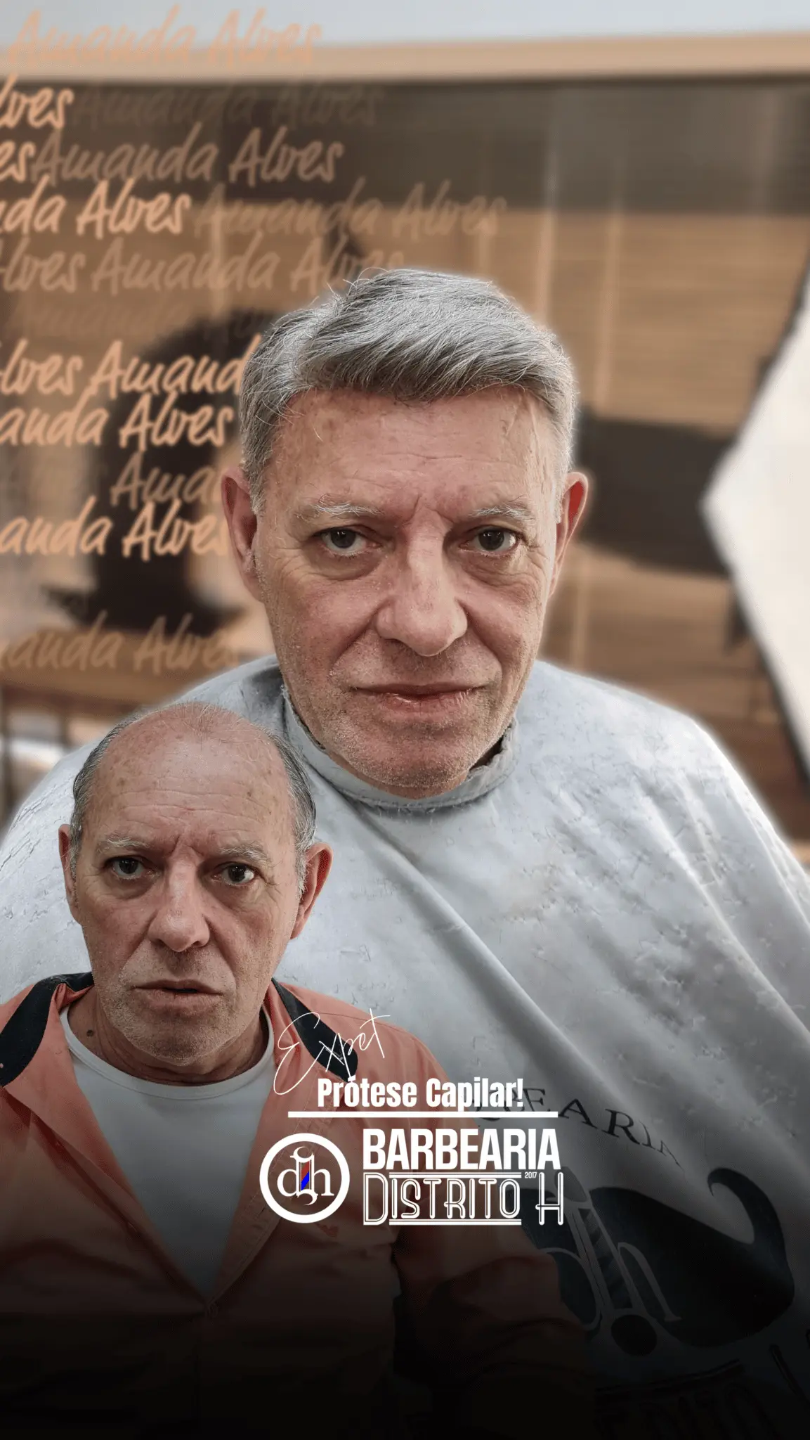 Resultado de Prótese Capilar